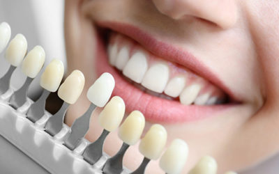 Dental Implants: Definition, Procedures, and Benefits – Bristol UK