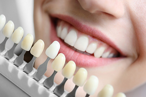 Dental Implants: Definition, Procedures, and Benefits – Bristol UK