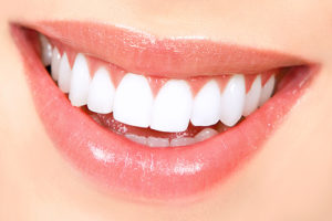 White Fillings 300x200 - Purple Dental Care Bristol