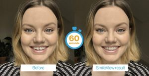 Smile View