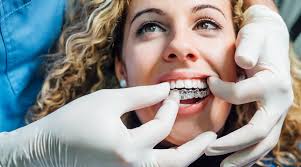 Patient wearing Invisalign clear aligners in everyday life